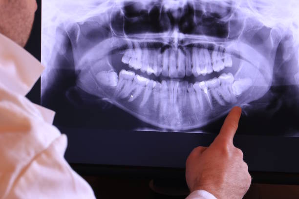 Best Tooth Pain Emergency Relief  in Coosada, AL