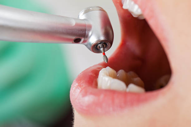 Best Urgent Tooth Repair  in Coosada, AL